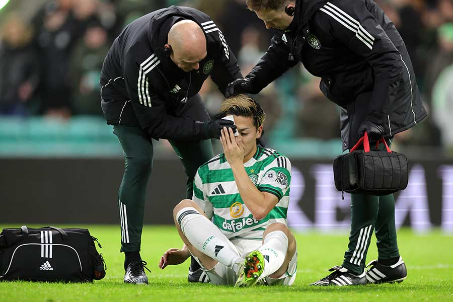 相手と競り合い、頭部付近を負傷したセルティックの前田大然(中央)【写真:PA Images/アフロ】