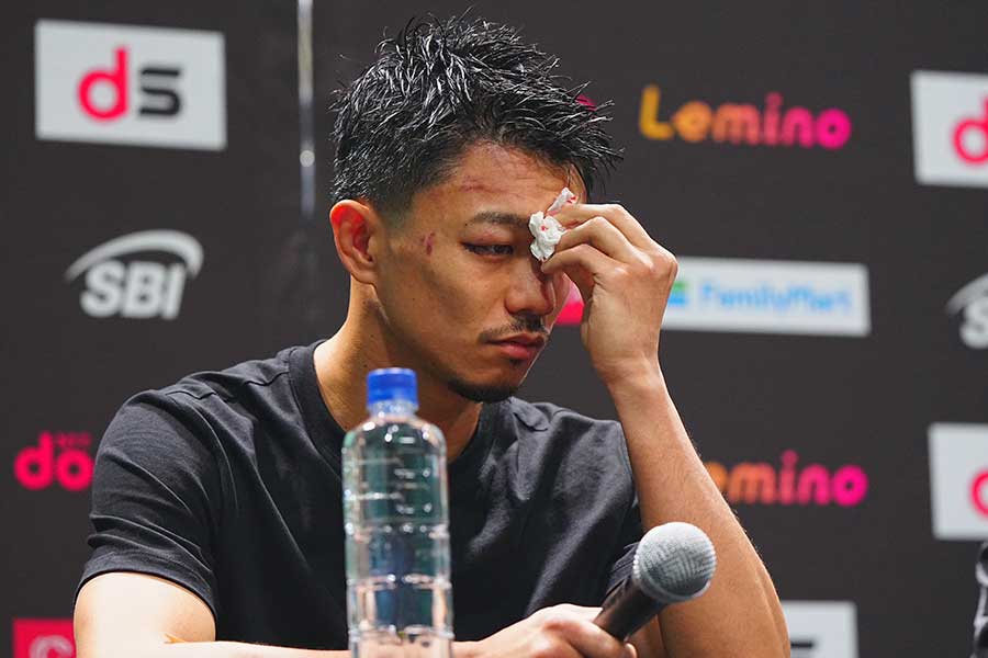 顔は傷だらけ。骨折疑いの中、会見に出席した中谷潤人【写真：荒川祐史】